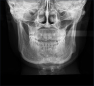 骨骼X光片检查