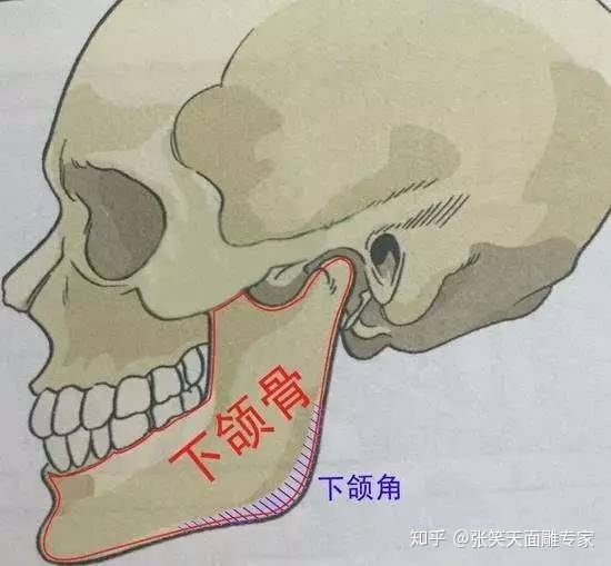  下颌角整形的常见方法
